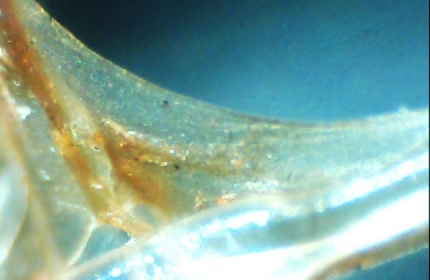 TẮC NGHẼN MÀNG RO DO BIOFILM VÀ CÁC BIỆN PHÁP KHỐNG CHẾ